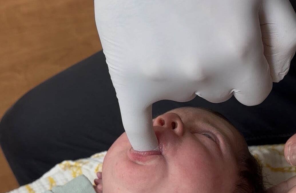 Tongue Tie, Body Tension, and Why Both Matter